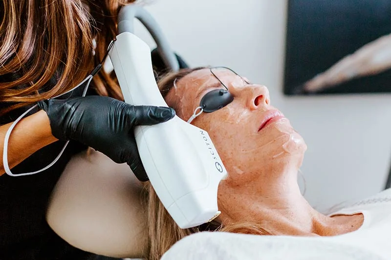 BBl Photofacial | Mclean VA | Dermaglow Med Spa