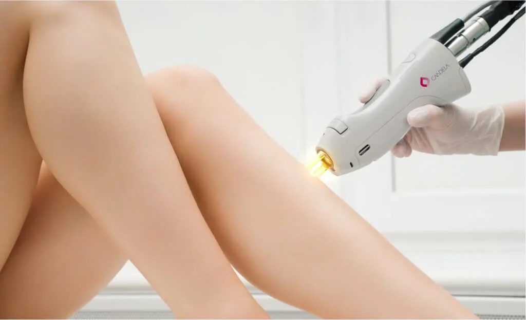 Laser Hair Removal | Mclean VA | Dermaglow Med Spa