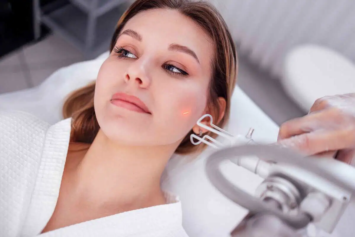 Cartessa Helix CO2 Laser skin resurfacing treatment for smoother, healthier-looking skin in McLean, VA