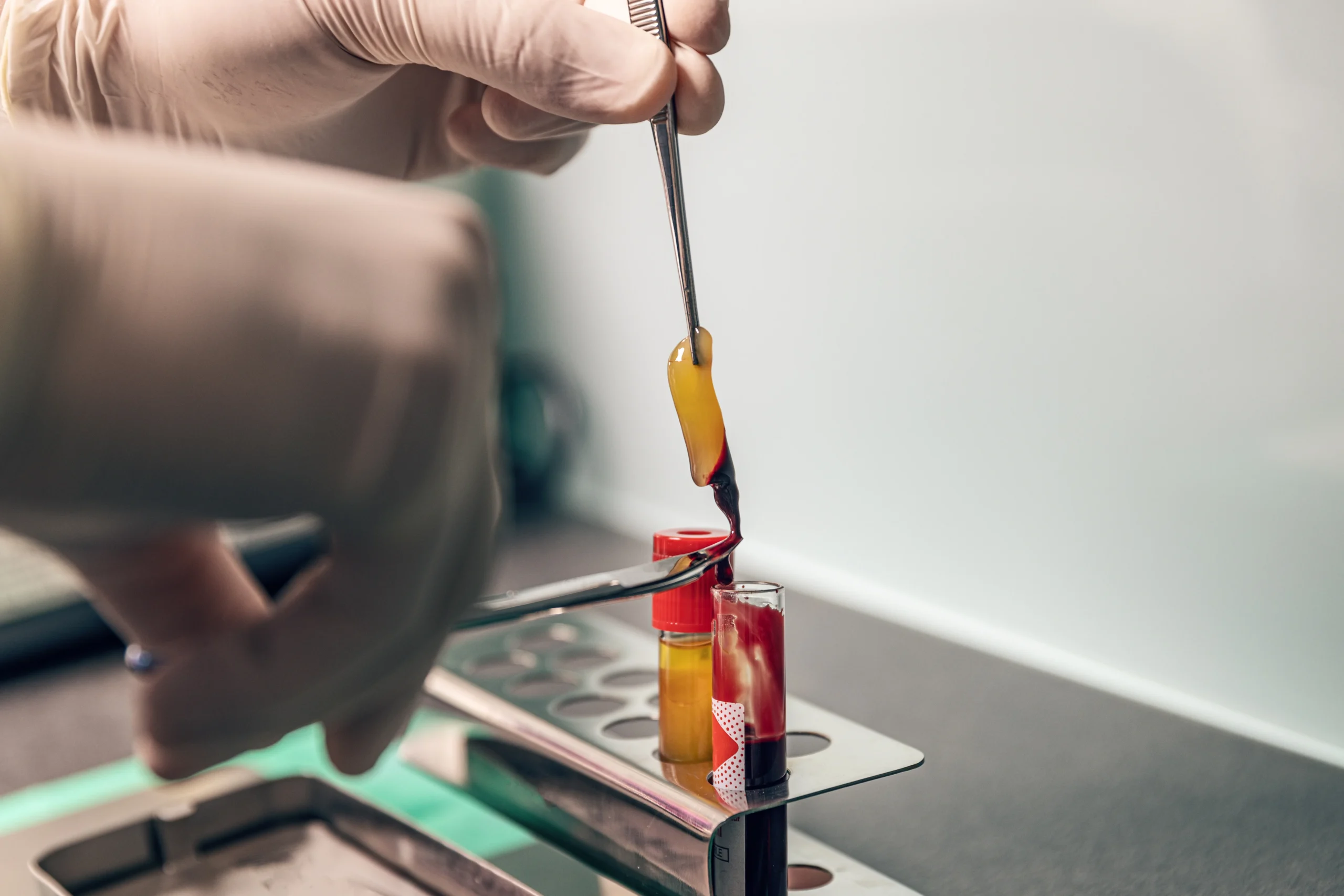 PRP in McLean, VA | Dermaglow Medspa